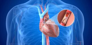 Prof. Dr. Koylan Uyardı: Koroner Bypass veya Stent Sonrası rehavete kapılmayın! Koroner arter hastalıkları